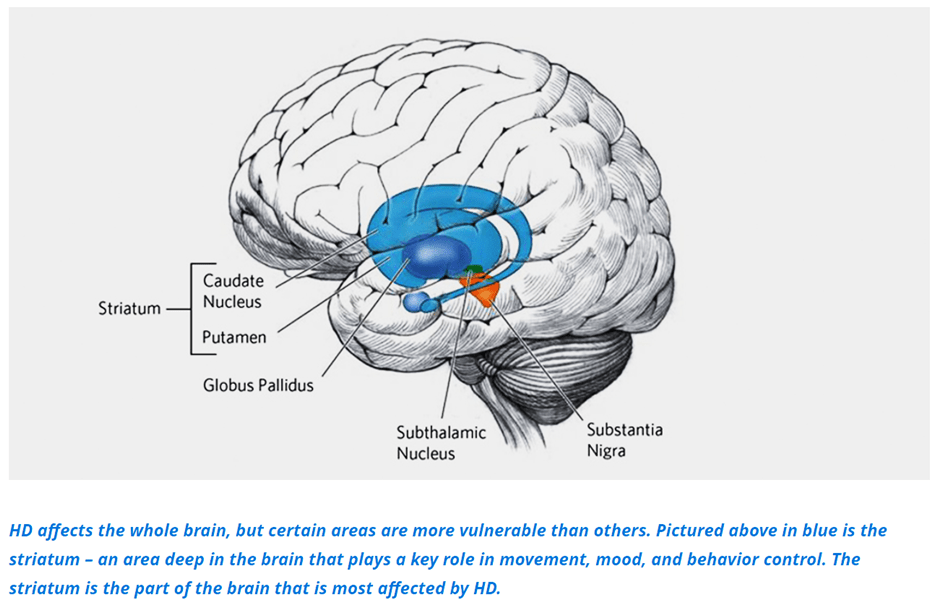 Huntington's Disease